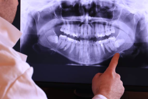 Best Walk-In Emergency Dentist in Madisonville, LA